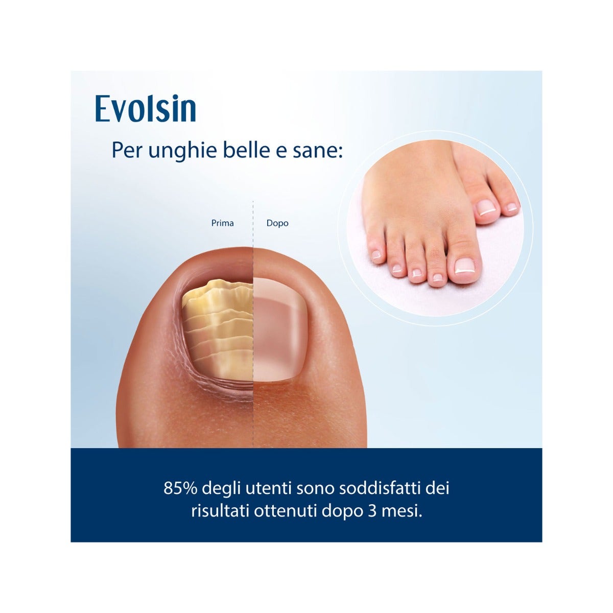 Evolsin Líquido Antimicótico para Uñas 10 ml