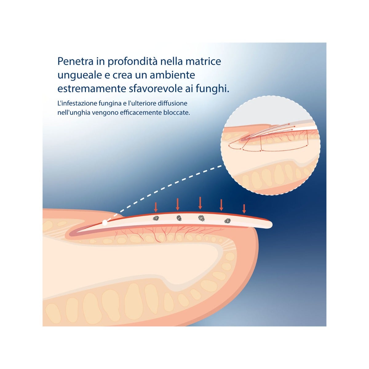 Evolsin Líquido Antimicótico para Uñas 10 ml