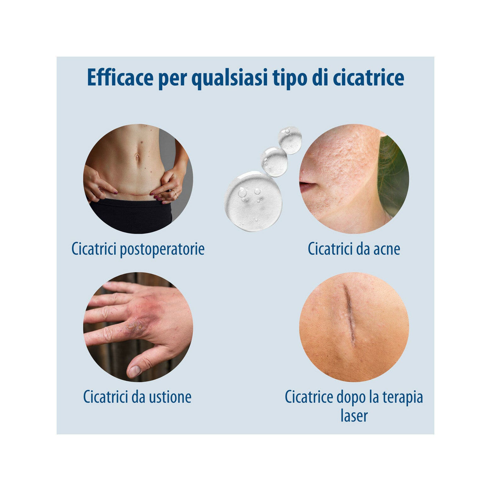Evolsin Gel de silicona para cicatrices para niños y adultos 20 g