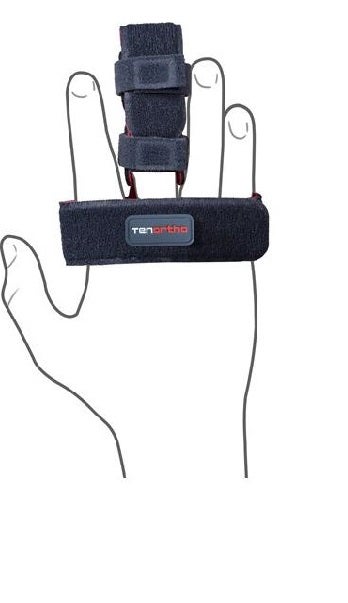 Tenortho Finger Brace Talla 2 Adulto-1