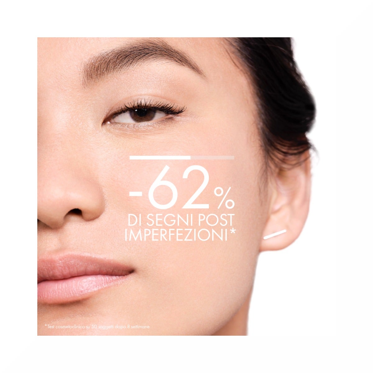 Vichy Normaderm Tratamiento Diario Anti-Imperfecciones 50ml-17