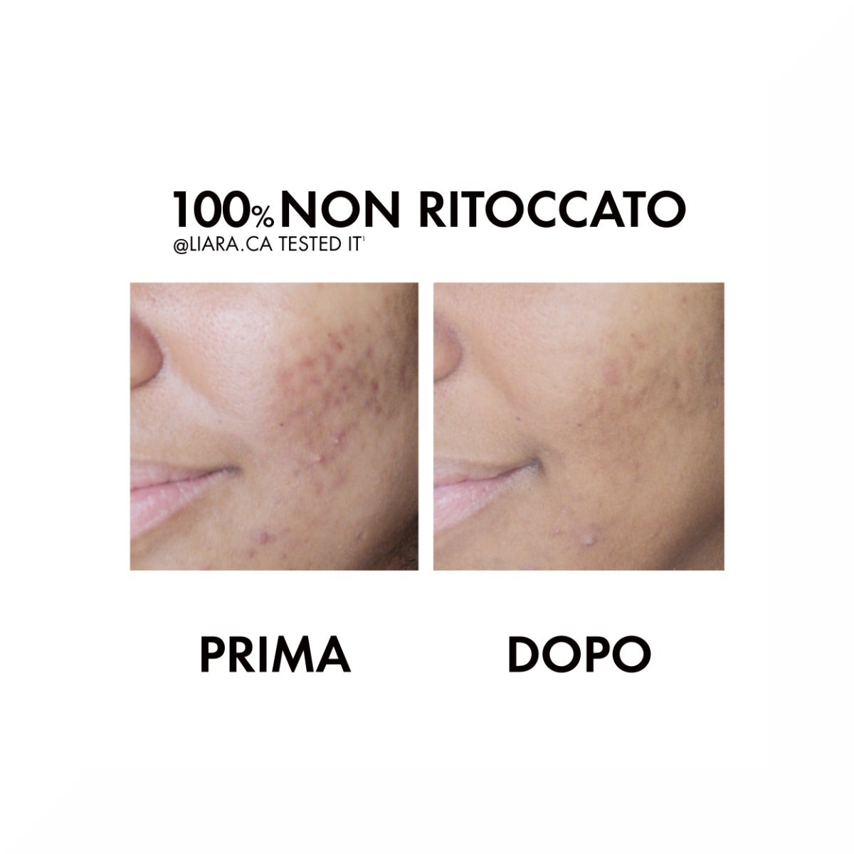 Vichy Normaderm Tratamiento Diario Anti-Imperfecciones 50ml-18
