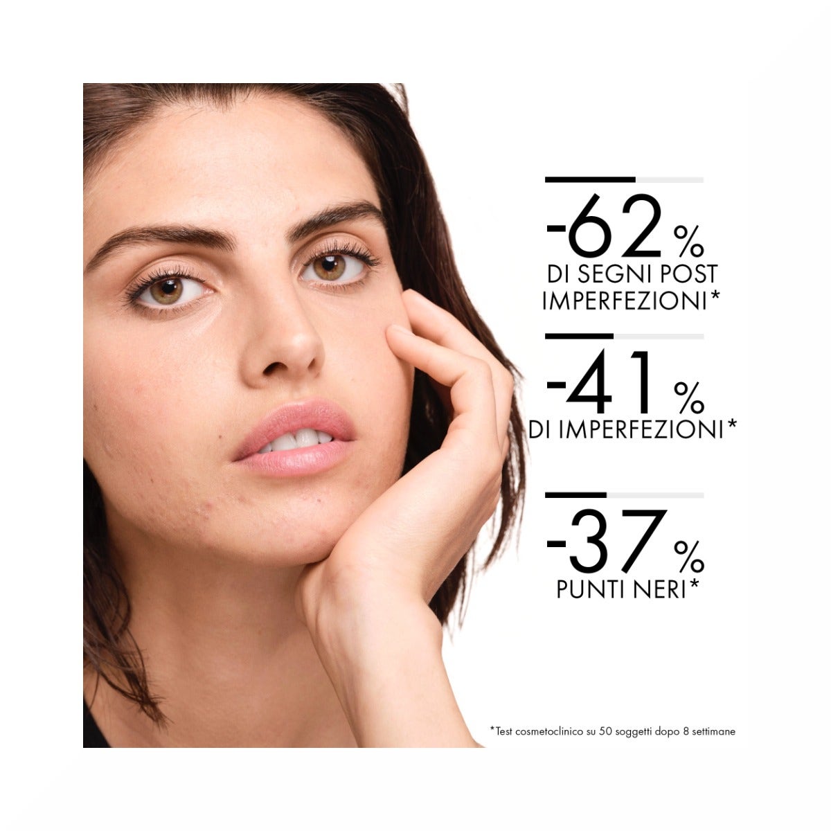 Vichy Normaderm Tratamiento Diario Anti-Imperfecciones 50ml-25