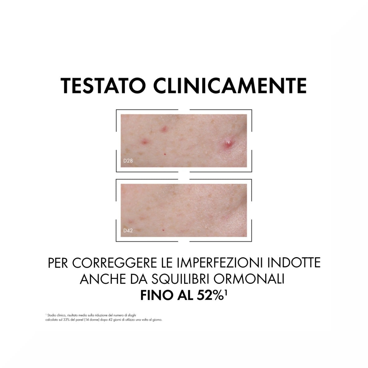 Vichy Normaderm Probio-BHA Sérum Facial Anti-Imperfecciones 30ml-17