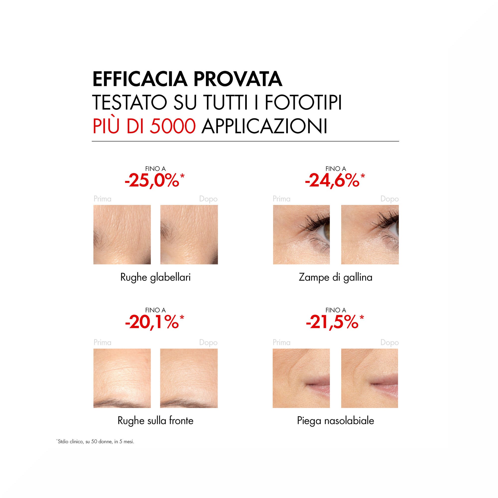 Vichy Liftactiv Retinol Specialist Sérum Antiarrugas 30ml-5