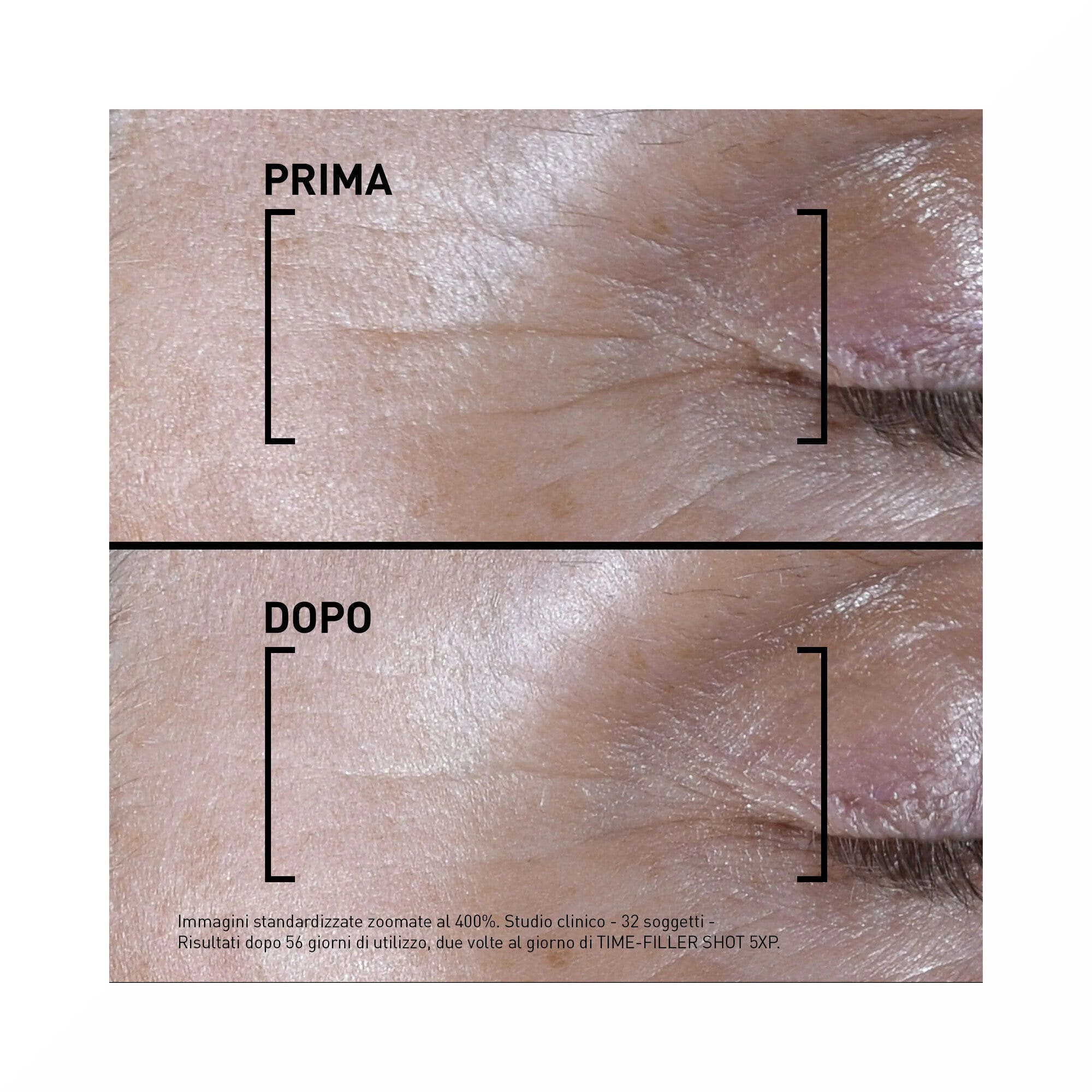 Filorga Time Filler Shot 5xp Suero Concentrado para Líneas de Expresión 15 ml