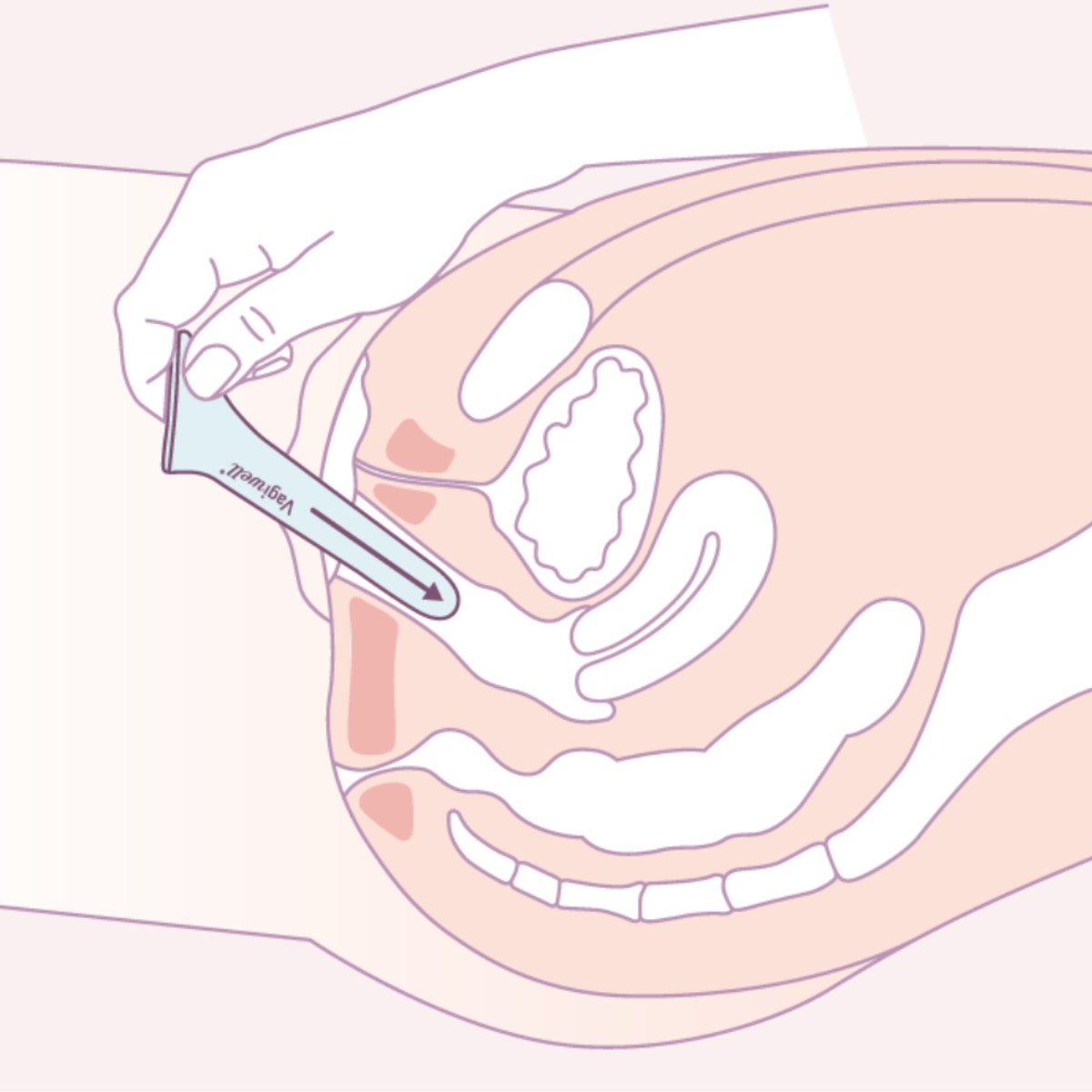Vagiwell Dilatatore Vaginale Misura 5