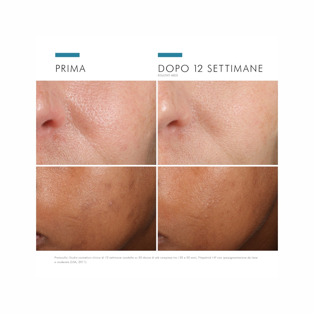SkinCeuticals Phloretin CF Siero Viso Antiossidante Con Vitamina C 30 ml-6