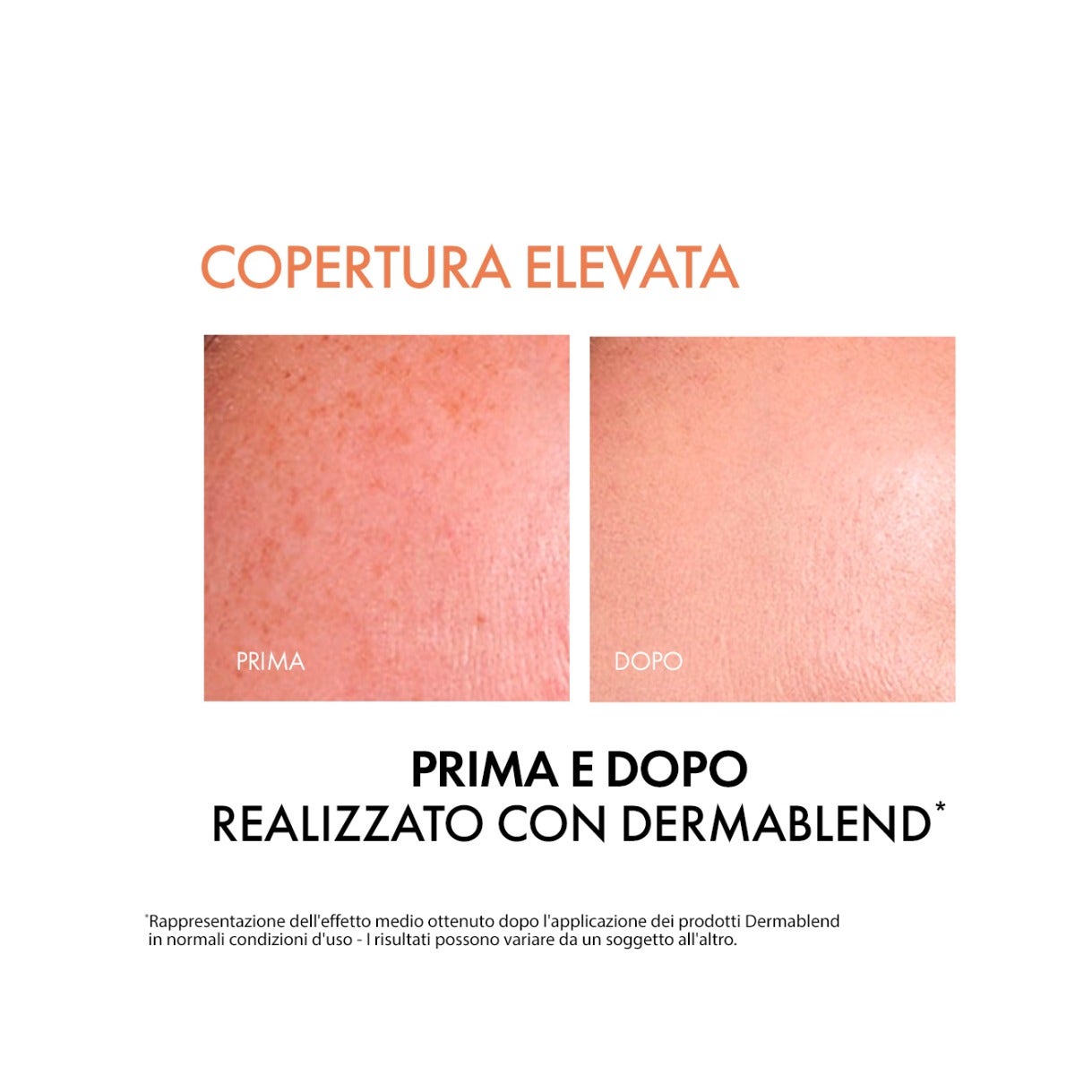 Vichy Dermablend Base de Maquillaje Fluida Cobertura Tonos 25 30ml SPF35-11
