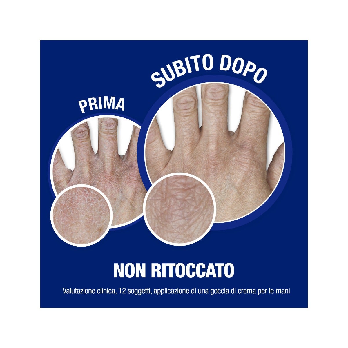 Neutrogena Fórmula Noruega Crema de Manos para Uñas 75ml-13