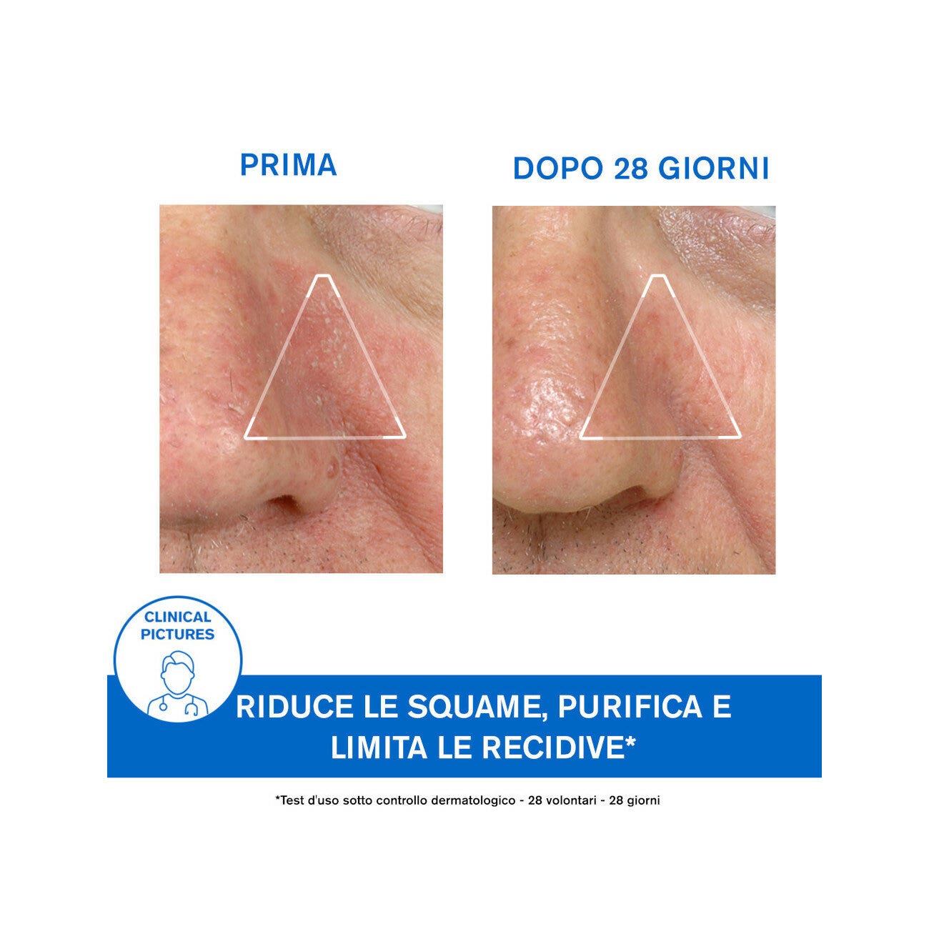 Uriage DS Emulsione 40ml-9