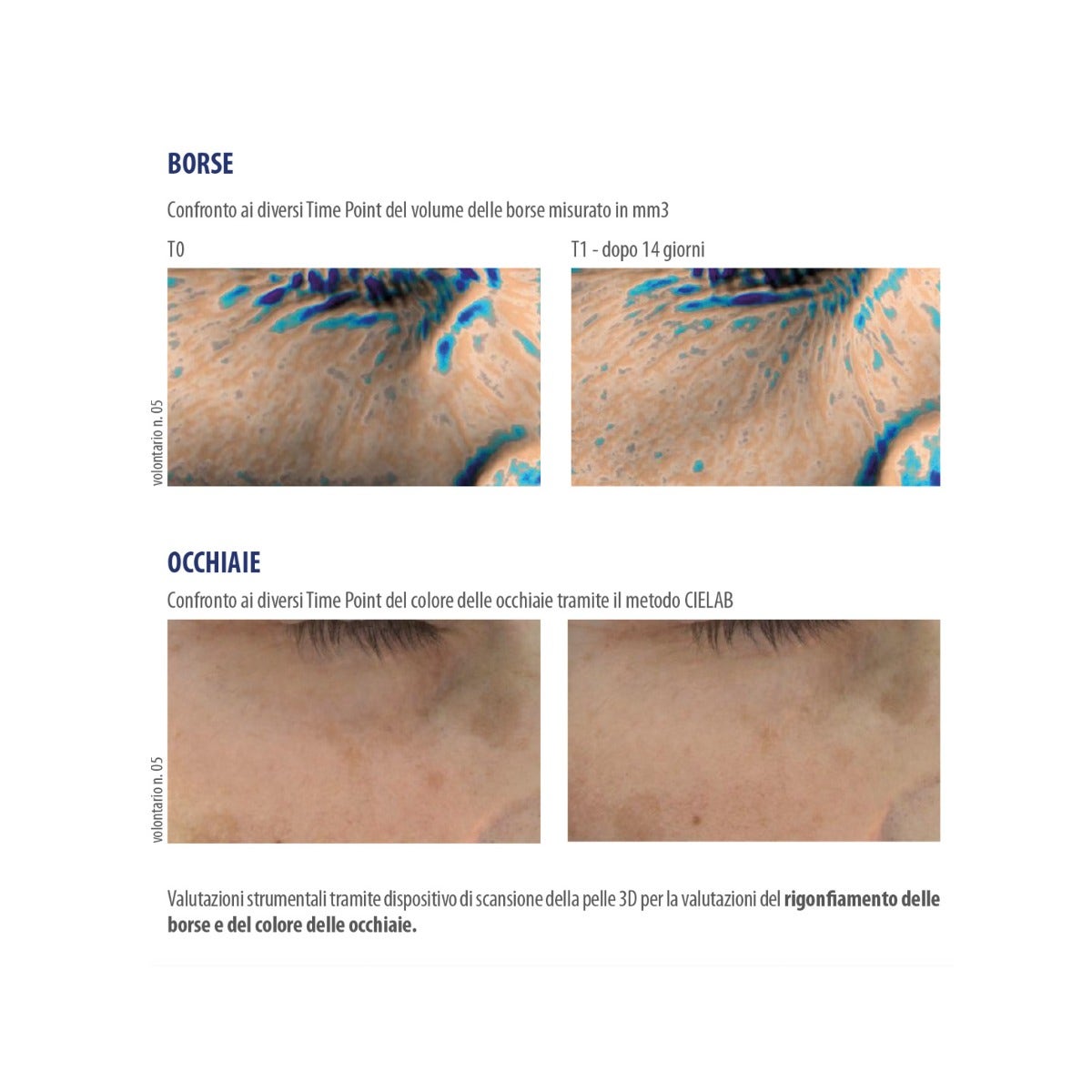 Helan Ireos Serum Contorno de Ojos Lifting Gel Iluminador Antihinchazones Antiojeras 10ml-3