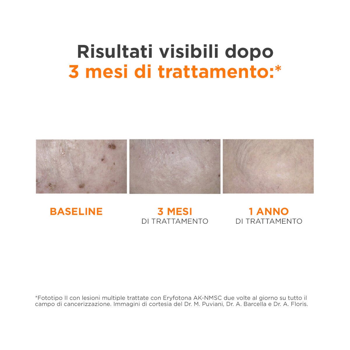 Isdin Eryfotona AK-NMSC Fluido SPF100+ 50ml-4