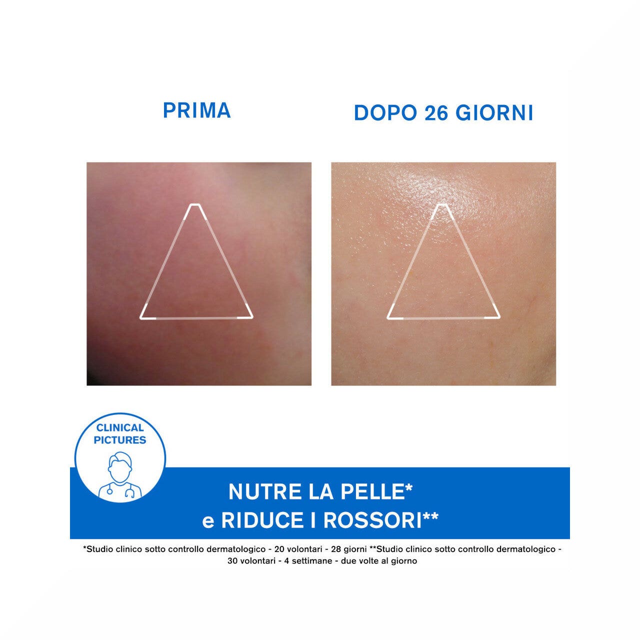 Uriage Xemose Crema Rostro 40ml-9
