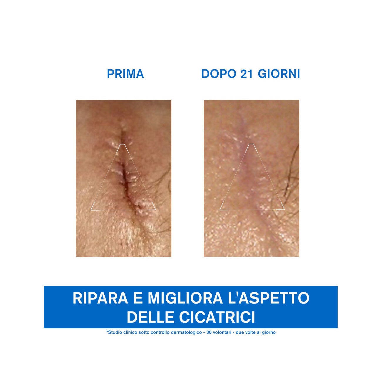 Uriage Bariederm Cica-Crema 100ml-8