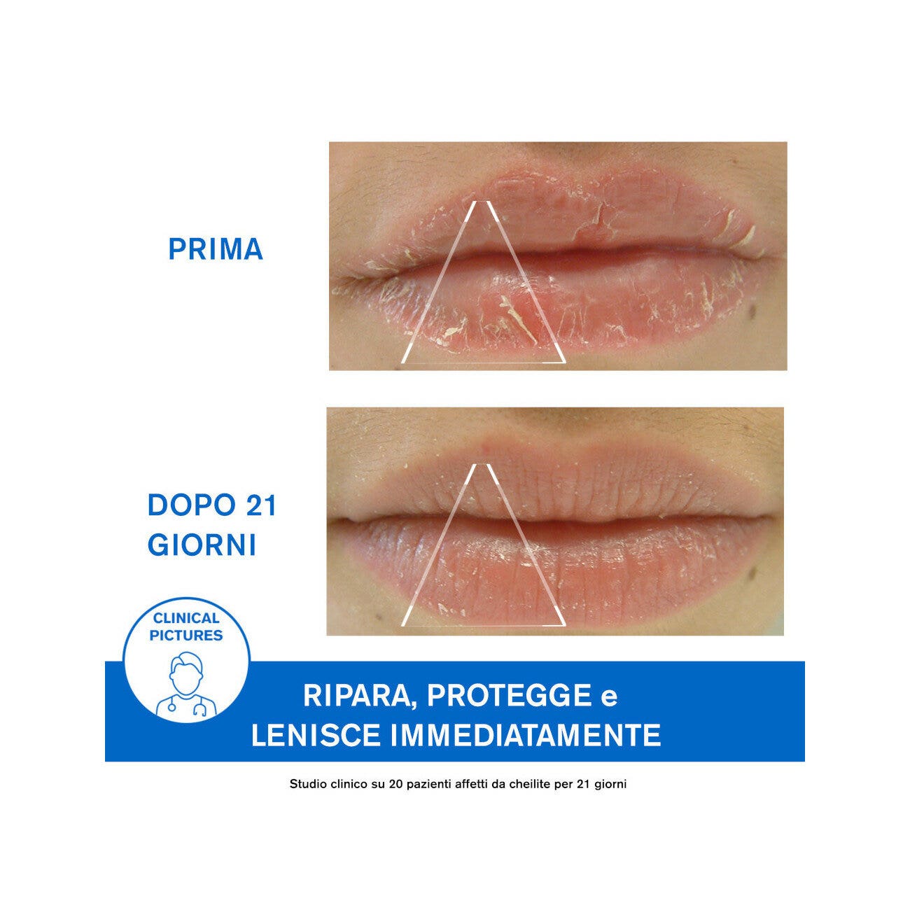Uriage Bariederm Cica-Levres Crema Protectora de Labios 15ml-9