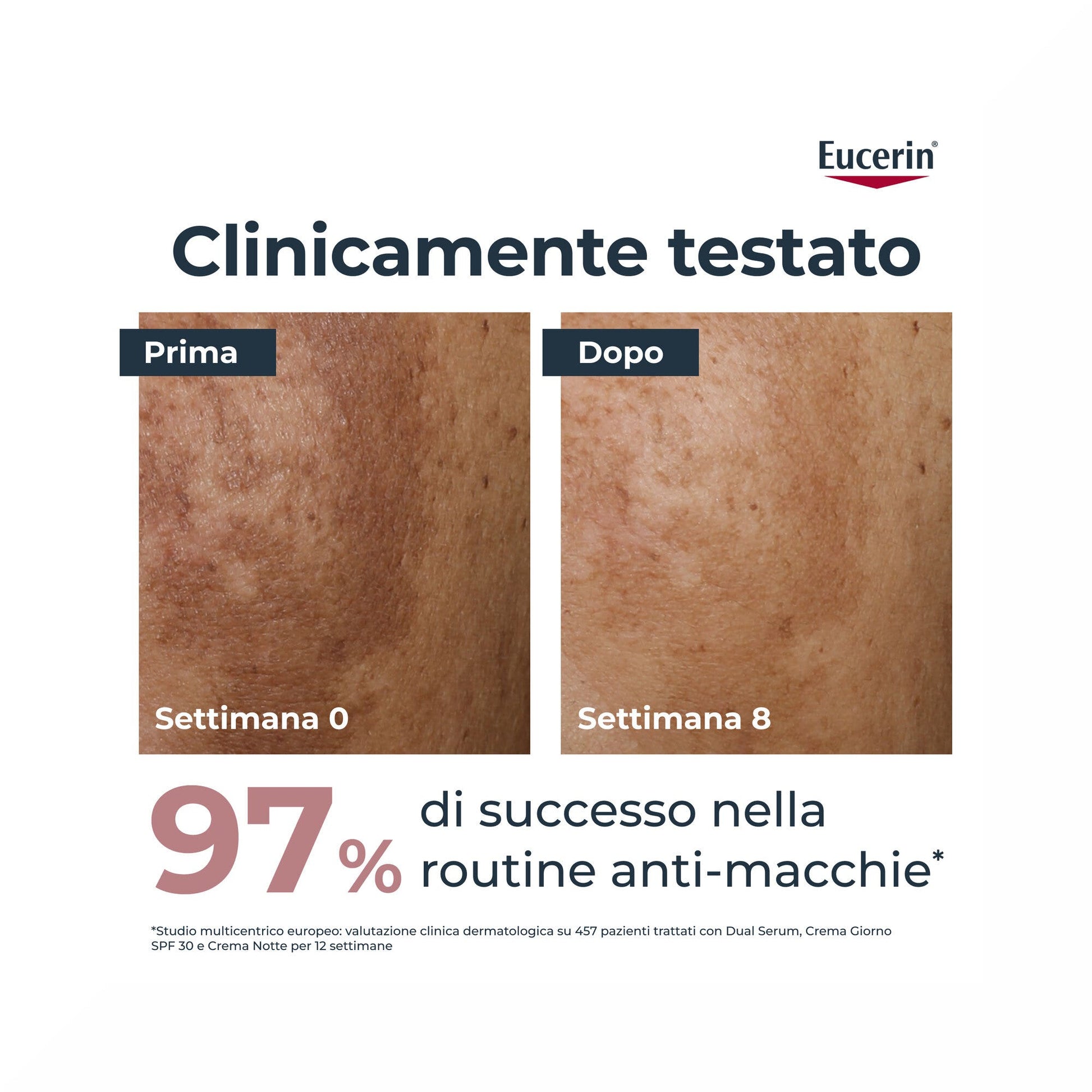 Eucerin Anti-Pigment Día SPF30 50ml-3