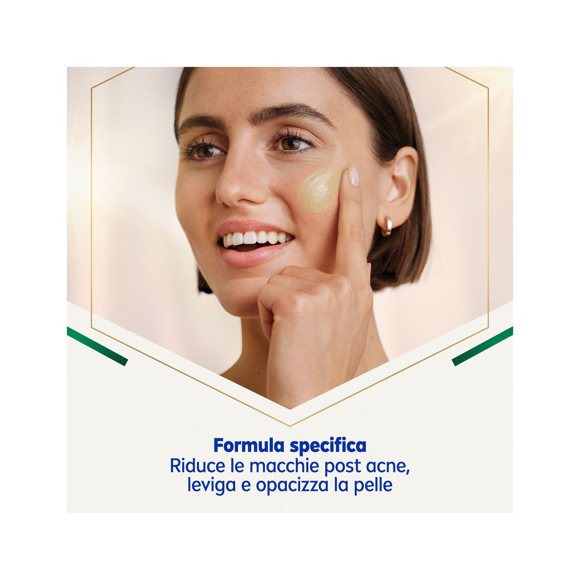 Nivea Luminous630 Siero Viso Anti-macchie Acne E Pelle Grassa 30ml