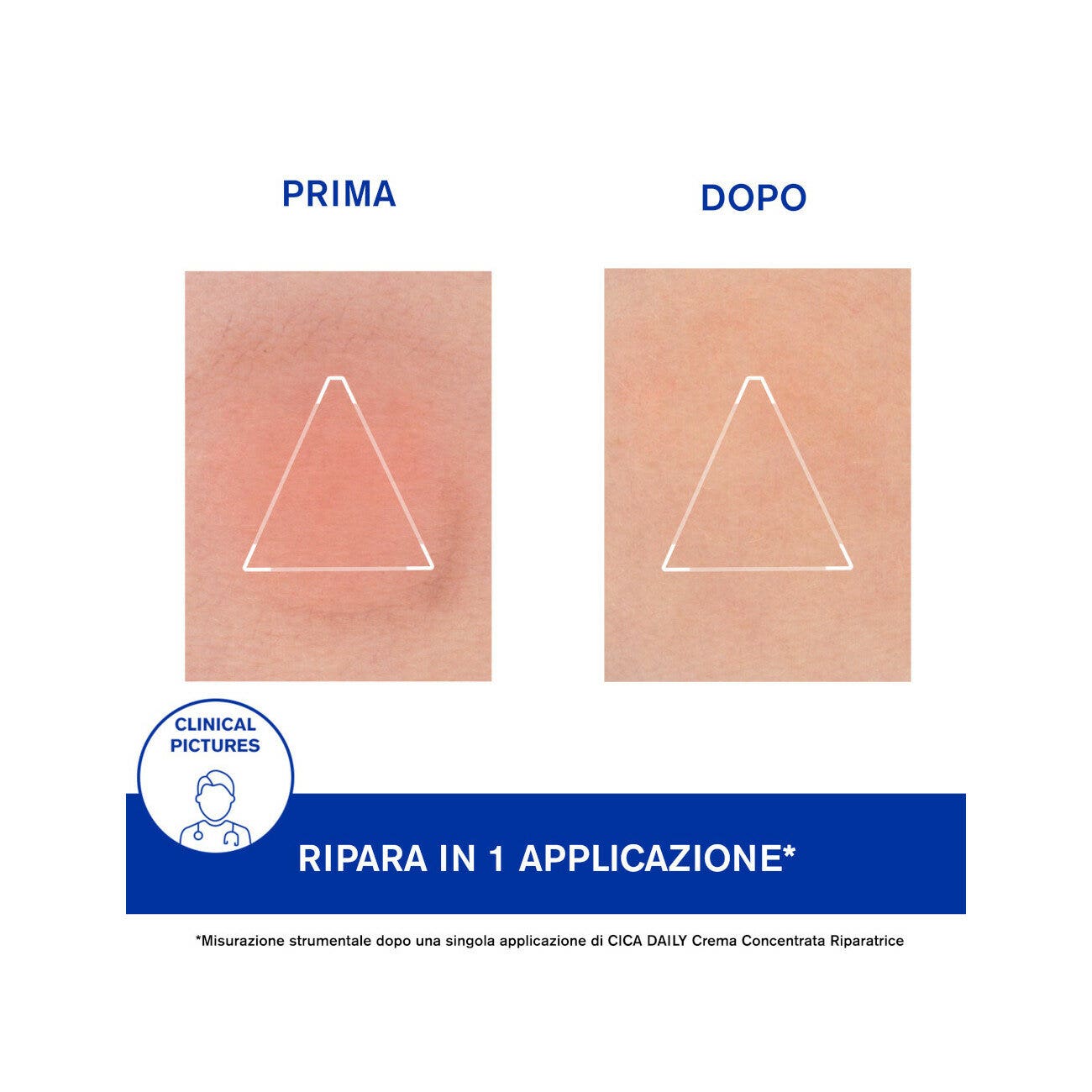 Uriage Cica Daily Crema Concentrada Reparadora 50 ml